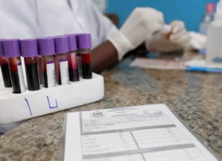 How Much Does a Full Blood Test Cost in Ghana? 2026 Price Guide How Much Does a Full Blood Test Cost in Ghana? 2026 Price Guide