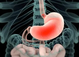Acid Reflux and Heartburn: Causes, Quick Relief, and Prevention Acid Reflux and Heartburn: Causes, Quick Relief, and Prevention